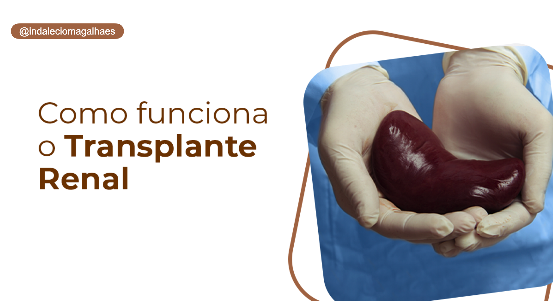 Transplante Renal: O caminho para uma nova vida